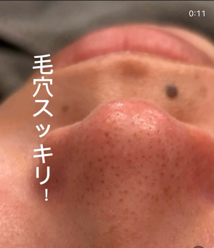 毛穴スッキリ✨